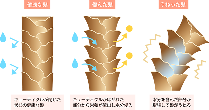 髪の悩み画像